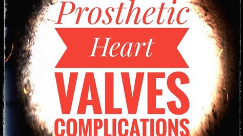 Complications Associated With Prosthetic Heart Valves Youtube