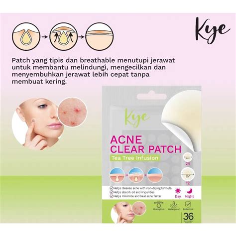 Kye Acne Clear Patc 36pads Shopee Philippines
