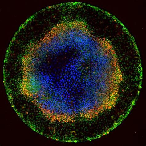New Research Supports Theory That Cancer Is A ‘stem Cell