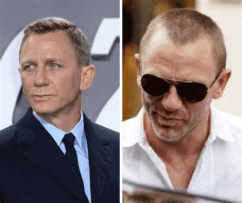 Male Celebrities With Hair Loss Celeb With Baldness