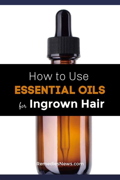 How To Use Essential Oils For Ingrown Hair 8 Best Home Remedies