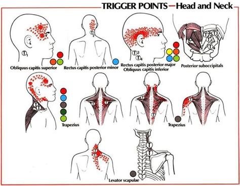 Trigger Points Head And Neck Neuromuscular Therapy Trigger Points