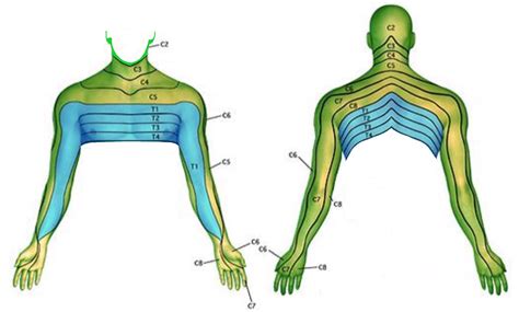Neck And Arm Pain Spines Dorset Dermatome Map Sexiz Pix