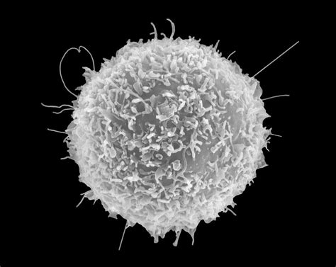 Human T Lymphocyte Photograph By Dennis Kunkel Microscopyscience Photo