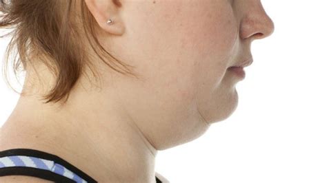 3 Simple Exercises To Get Rid Of Double Chin Updated Trends