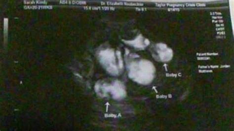 The Fake Ultrasound Image Was Obtained Via