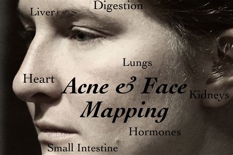 When you have a breakout, it can feel like you're walking around with a flashing neon sign on your face that says, zit alert!! how can you banish those this is called acne face mapping. Face Mapping: What Are Your Acne Breakouts Telling You ...