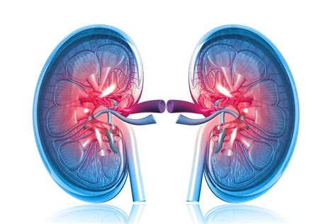 Síntomas De La Insuficiencia Renal Que Debes Conocer Recetas Con Plátanos