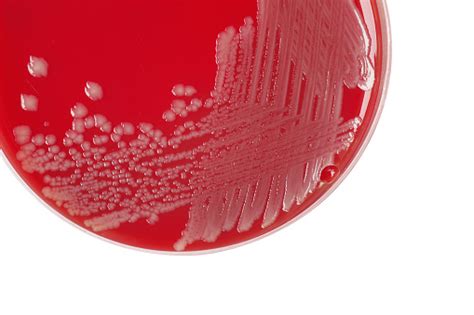 Salmonella Enteritidis Bacterial Colonies On Blood Agar Plate M Stock