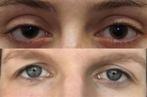 Hunter (Predator) Eyes vs Prey Eyes in Humans: What Is It And How To Get It