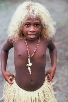 It is a dominant genetic trait. Melanesians