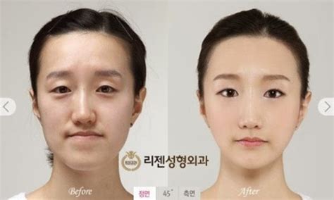 South Korea Plastic Surgery Funnymadworld