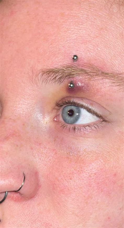 Bruised Eyebrow Piercing Not Sure Whats Wrong With It Rpiercing