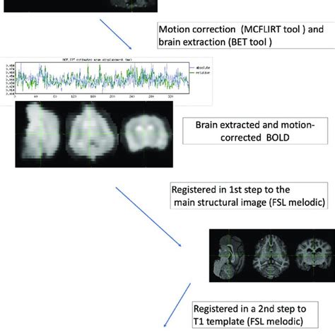 Schematic Representation Of The Pre Processing Of Fmri Data The First