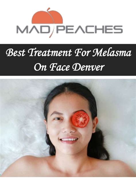 Best Treatment For Melasma On Face Denver