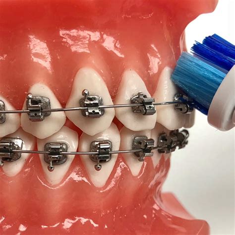 Behandelingen Orthodontiepraktijk Den Helder