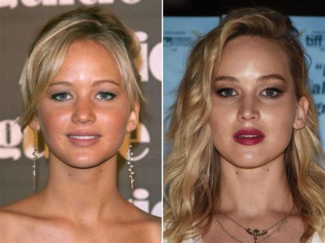 Jennifer Lawrence Before And After Jennifer Lawrence Plastic Surgery