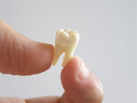 Tooth Extraction Procedure Costs Healing And Pain Relief