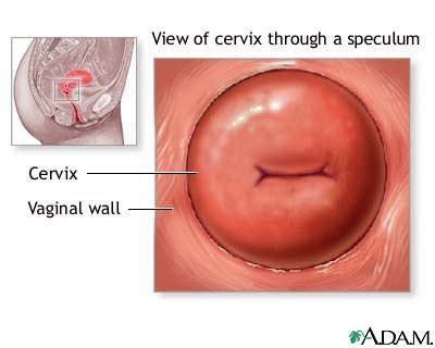 When your care provider does a pelvic check, he or she may say that your cervix is soft or he/she may even say a certain percentage your cervix is effaced. Pin on Getting Pregnant