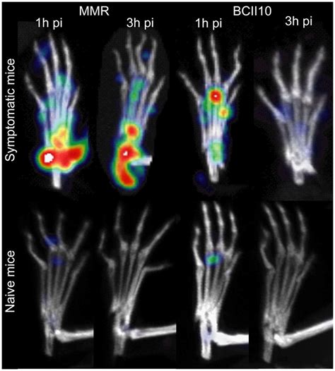Spect Imaging Of Joint Inflammation With Nanobodies Targeting The