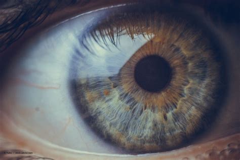 Improve Patient Comfort With Intravitreal Injections