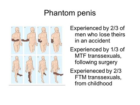 Enlarged Clitorious From Testosterone Ftm Slideshare