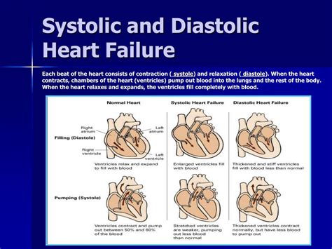 Ppt Systolic And Diastolic Heart Failure Powerpoint Presentation