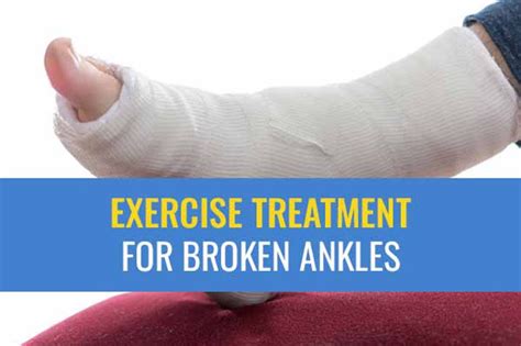 Exercise Treatment For Broken Ankles
