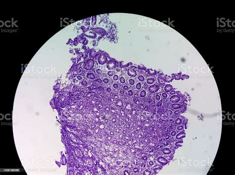 Slide Histologis Dari Sampel Jaringan Tutup Pandangan Mikroskopis