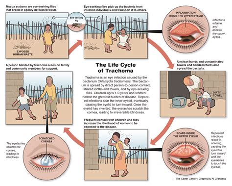 The Life Cycle Of Trachoma International Trachoma Initiative