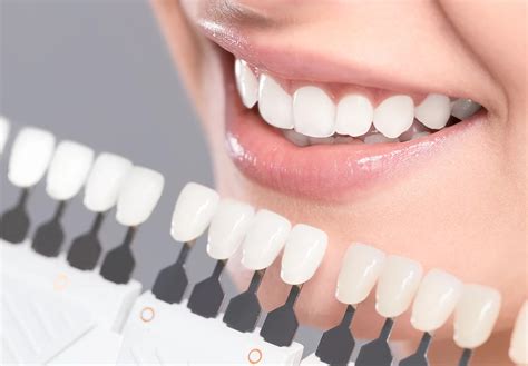 Facetas De Porcelana Facco Odontologia