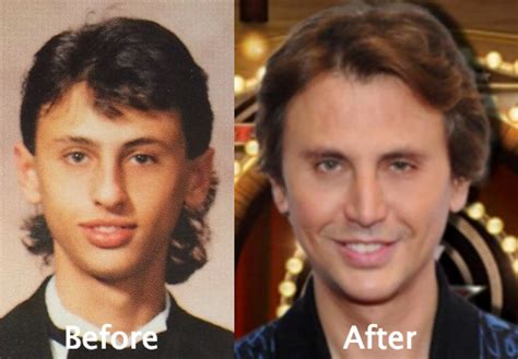 Jonathan Cheban Plastic Surgery Before And After Photos