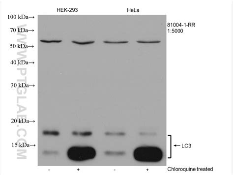 Lc3 Antibody 81004 1 Rr Proteintech