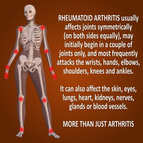 Rheumatoid Arthritis Back In Action