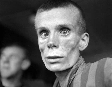 An Emaciated 18 Year Old Russian Girl Looks Into The Camera Lens During