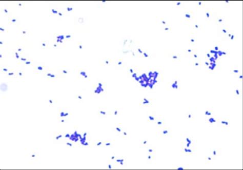 Gram Stain Of A Shaalii Download Scientific Diagram