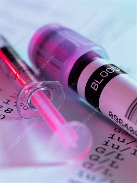 Blood Sample Stock Image F0034084 Science Photo Library