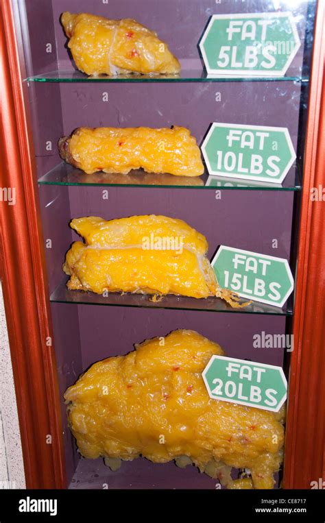 Body Fat Comparison Stock Photo Alamy