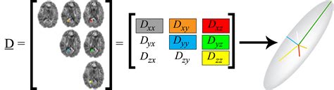 The Diffusion Tensor And Its Relation To Fa Md Ad And Rd Diffusion