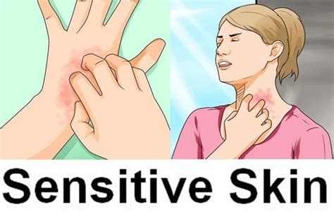 8 Symptoms That Will Tell You That You Have Sensitive Skin Sensitive