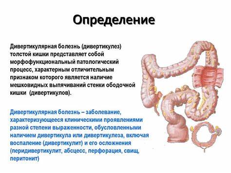 Диета с раком сигмовидной кишки Лечение народными средствами сигмовидной кишки: эффективные методы Лечение народными средствами сигмовидной кишки: эффективные методы Диета с раком сигмовидной кишки