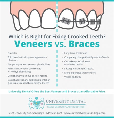 Using veneers for crooked teeth if you find that you suffer from one or more crooked teeth, you may not require braces to fix the problem. Which is rights for fixing crooked teeth? veneers vs ...