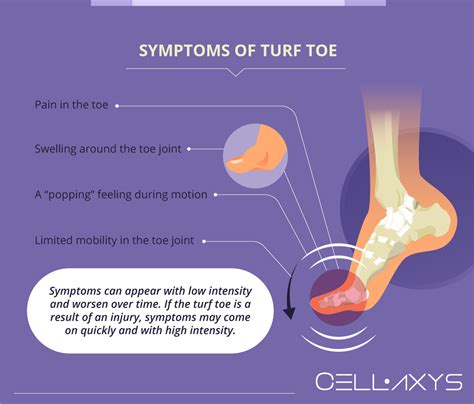 How To Minimize Turf Toe Recovery Time Cellaxys