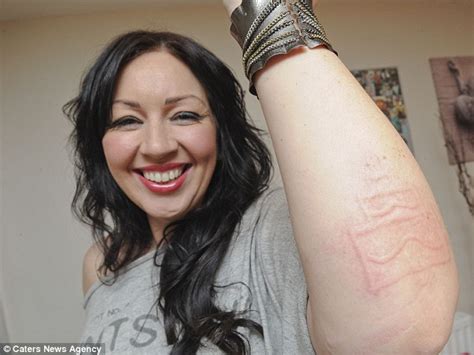 i m a human etch a sketch mother has rare condition which means she can draw on her skin and