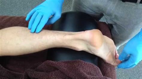 Dry Needling Flexor Hallucis Longus Youtube