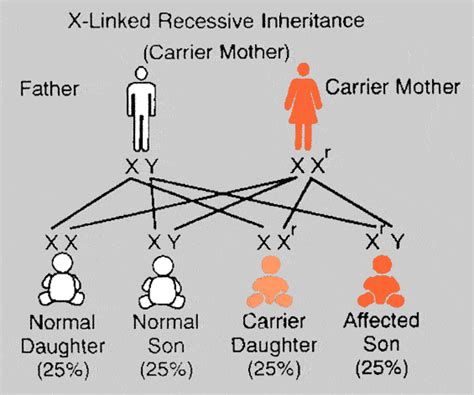 Recessive traits may skip generations and will affect both genders equally. Recessive, X-linked. Causes, symptoms, treatment Recessive ...
