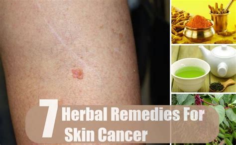 7 Amazing Herbal Remedies For Skin Cancer Mzizi Mkavu