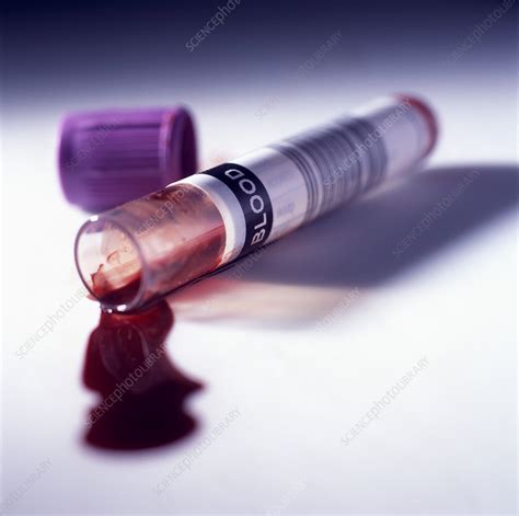 Blood Sample Stock Image M5300477 Science Photo Library