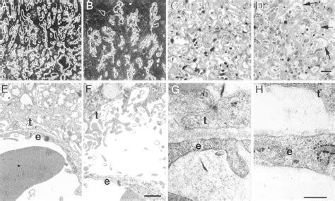 Placental Dysmorphogenesis In The Absence Of Laminin 5 A And B