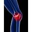 Does Joint Pain Actually Damage » West Fourth PhysiotherapyWest 